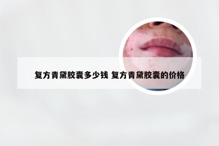 复方青黛胶囊多少钱 复方青黛胶囊的价格