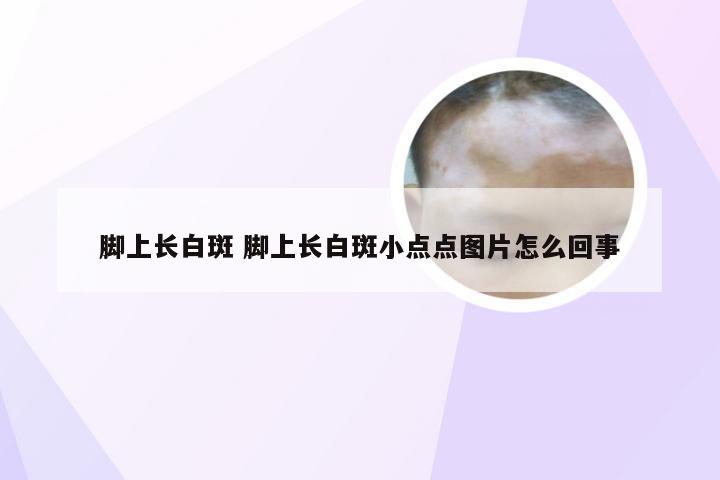 脚上长白斑 脚上长白斑小点点图片怎么回事