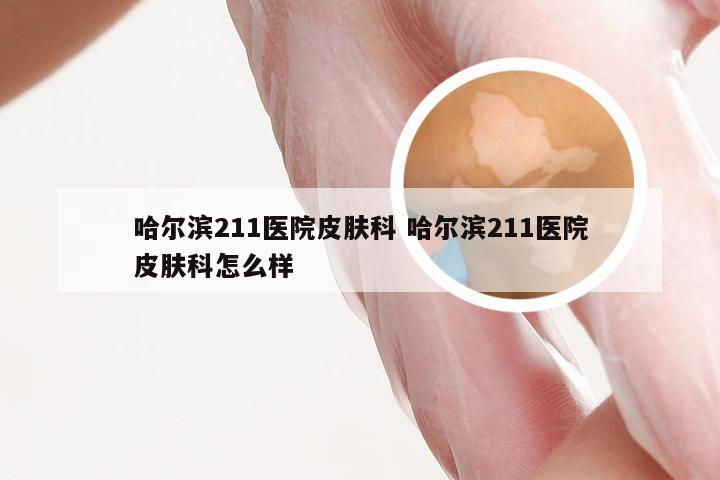 哈尔滨211医院皮肤科 哈尔滨211医院皮肤科怎么样