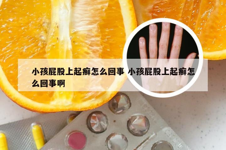 小孩屁股上起癣怎么回事 小孩屁股上起癣怎么回事啊