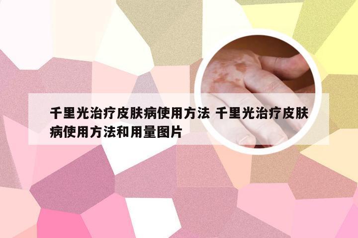 千里光治疗皮肤病使用方法 千里光治疗皮肤病使用方法和用量图片