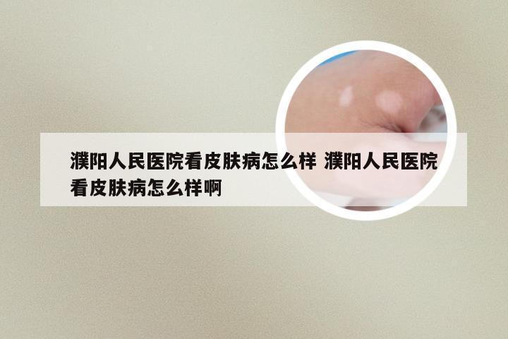 濮阳人民医院看皮肤病怎么样 濮阳人民医院看皮肤病怎么样啊