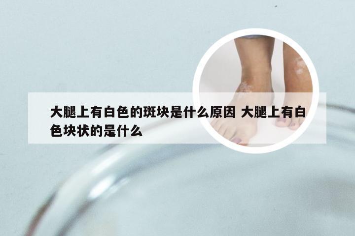 大腿上有白色的斑块是什么原因 大腿上有白色块状的是什么