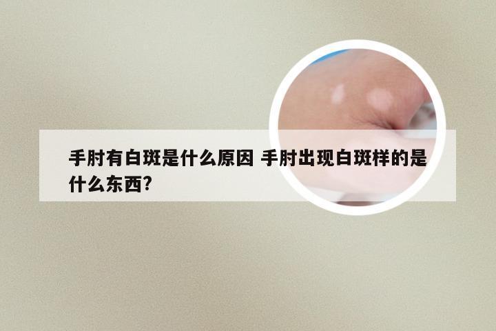 手肘有白斑是什么原因 手肘出现白斑样的是什么东西?