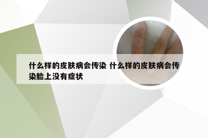 什么样的皮肤病会传染 什么样的皮肤病会传染脸上没有症状