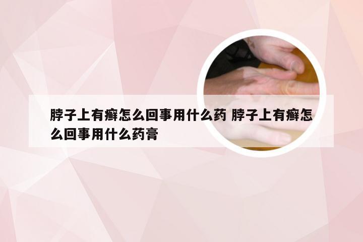 脖子上有癣怎么回事用什么药 脖子上有癣怎么回事用什么药膏