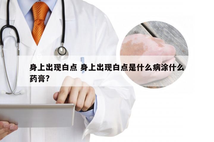 身上出现白点 身上出现白点是什么病涂什么药膏?