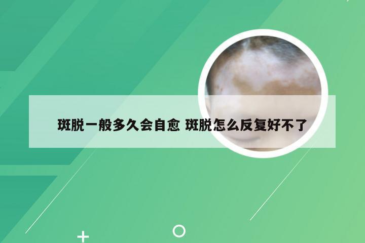 斑脱一般多久会自愈 斑脱怎么反复好不了