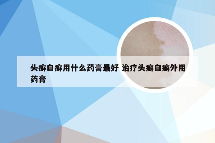 头癣白癣用什么药膏最好 治疗头癣白癣外用药膏