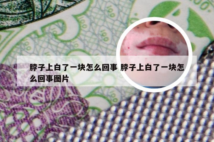 脖子上白了一块怎么回事 脖子上白了一块怎么回事图片