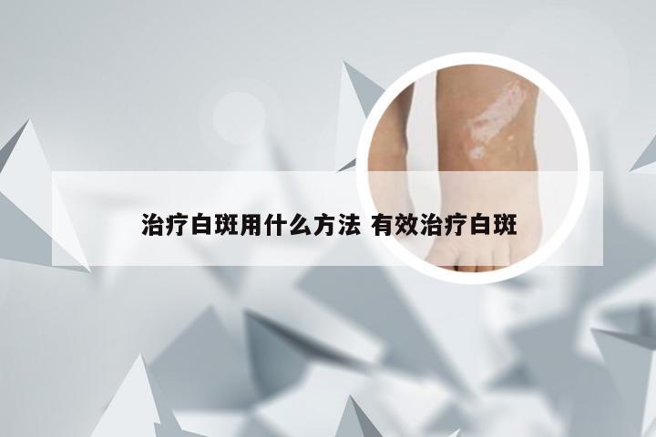 治疗白斑用什么方法 有效治疗白斑