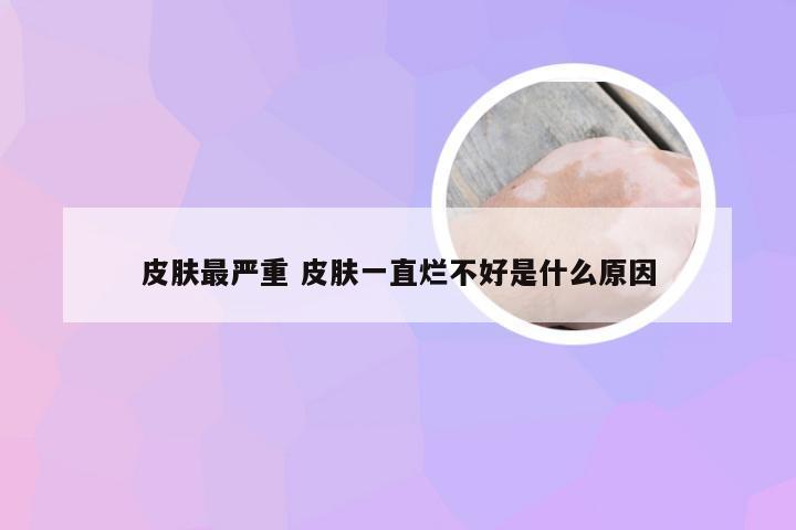 皮肤最严重 皮肤一直烂不好是什么原因