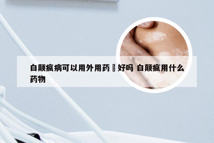 白颠疯病可以用外用药攃好吗 白颠疯用什么药物