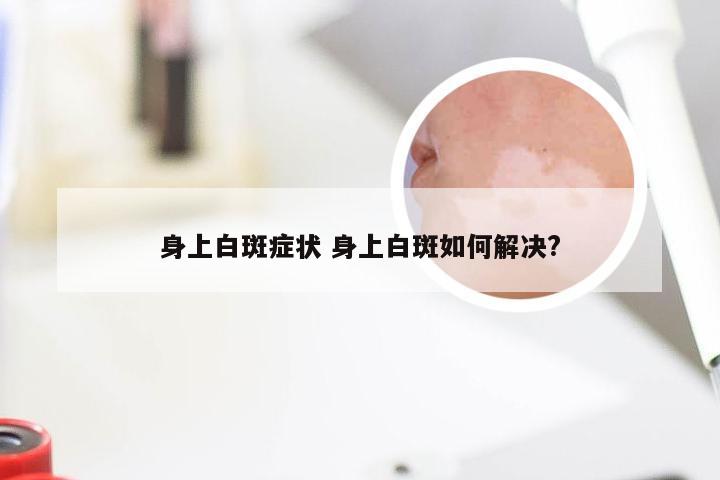 身上白斑症状 身上白斑如何解决?