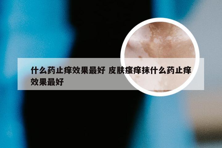 什么药止痒效果最好 皮肤瘙痒抹什么药止痒效果最好