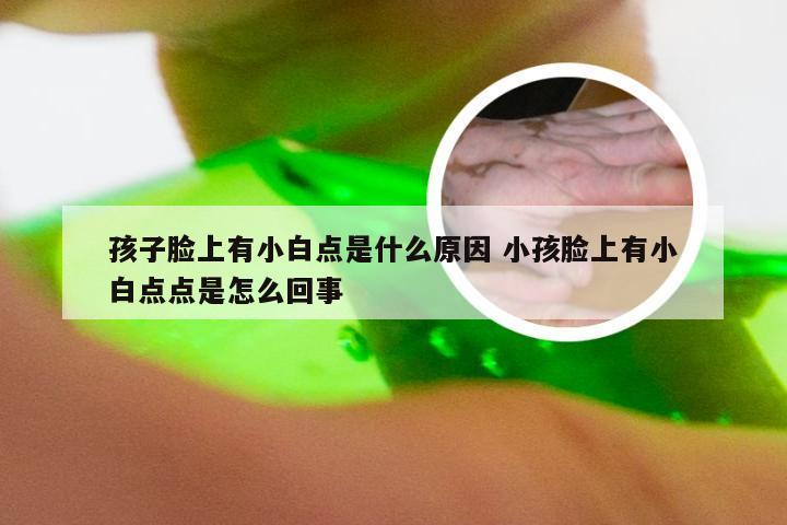 孩子脸上有小白点是什么原因 小孩脸上有小白点点是怎么回事