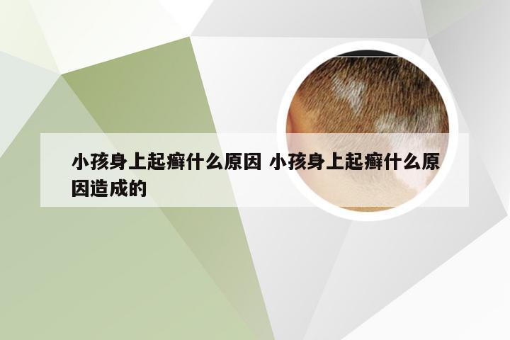 小孩身上起癣什么原因 小孩身上起癣什么原因造成的