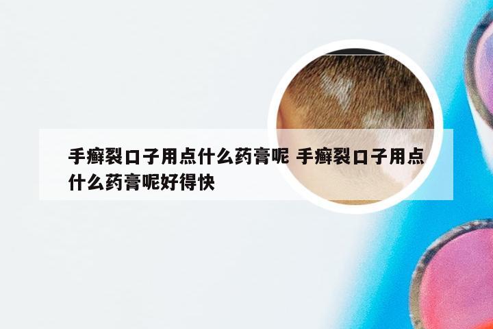 手癣裂口子用点什么药膏呢 手癣裂口子用点什么药膏呢好得快