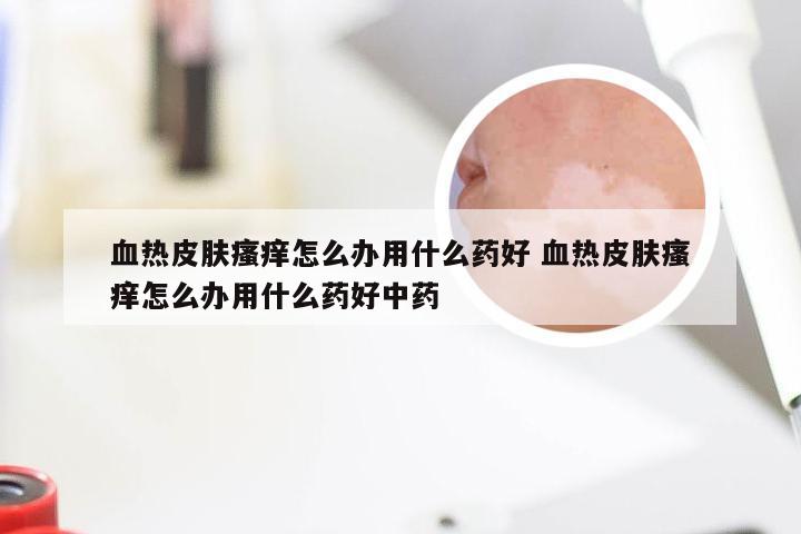 血热皮肤瘙痒怎么办用什么药好 血热皮肤瘙痒怎么办用什么药好中药