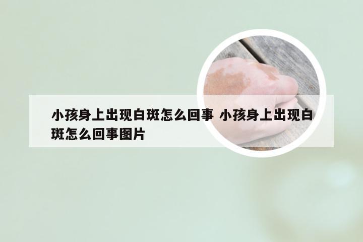 小孩身上出现白斑怎么回事 小孩身上出现白斑怎么回事图片