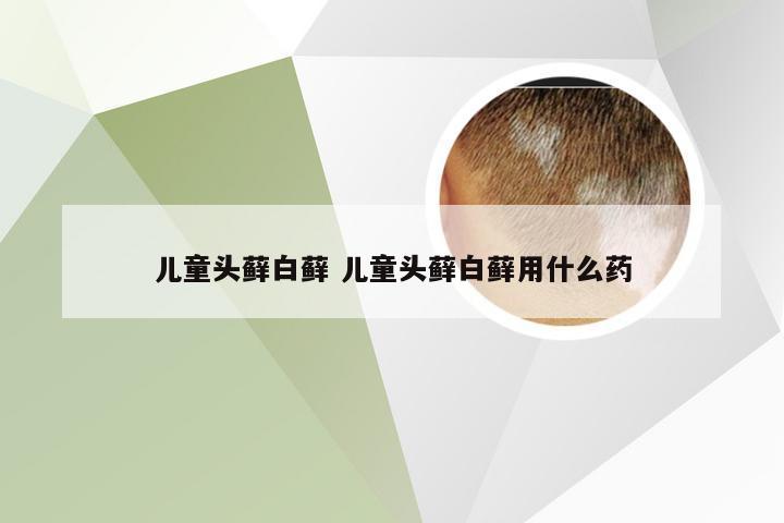 儿童头藓白藓 儿童头藓白藓用什么药