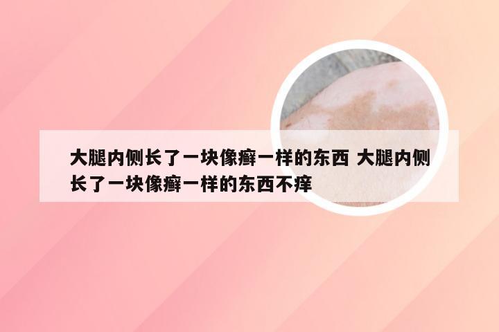 大腿内侧长了一块像癣一样的东西 大腿内侧长了一块像癣一样的东西不痒