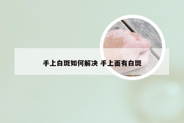 手上白斑如何解决 手上面有白斑