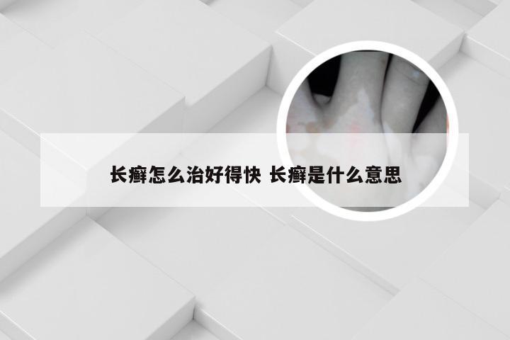 长癣怎么治好得快 长癣是什么意思