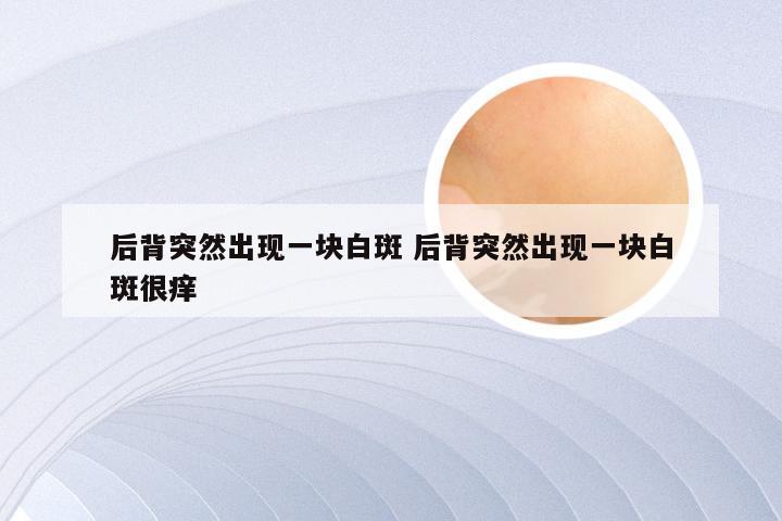 后背突然出现一块白斑 后背突然出现一块白斑很痒