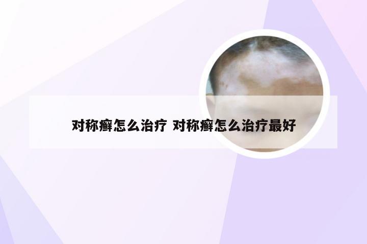 对称癣怎么治疗 对称癣怎么治疗最好