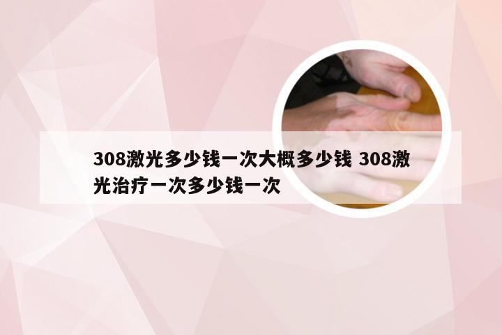 308激光多少钱一次大概多少钱 308激光治疗一次多少钱一次