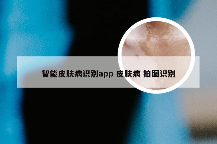 智能皮肤病识别app 皮肤病 拍图识别