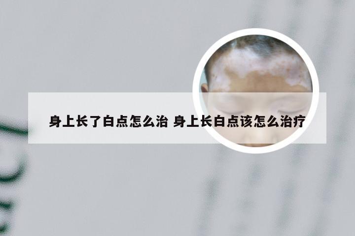 身上长了白点怎么治 身上长白点该怎么治疗