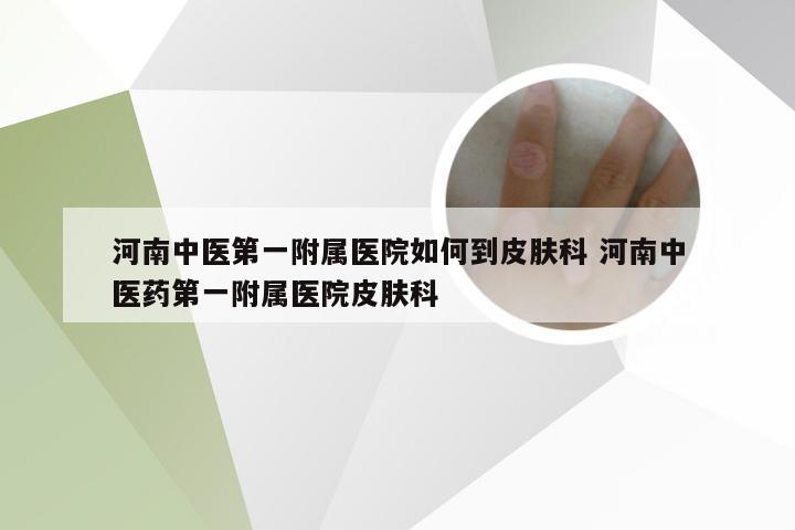 河南中医第一附属医院如何到皮肤科 河南中医药第一附属医院皮肤科