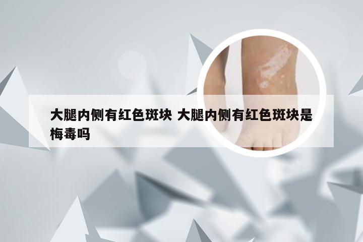 大腿内侧有红色斑块 大腿内侧有红色斑块是梅毒吗