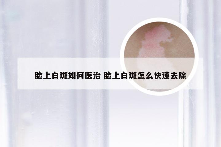 脸上白斑如何医治 脸上白斑怎么快速去除