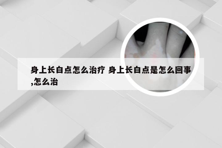 身上长白点怎么治疗 身上长白点是怎么回事,怎么治