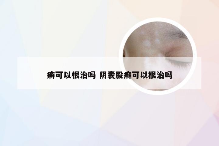 癣可以根治吗 阴囊股癣可以根治吗