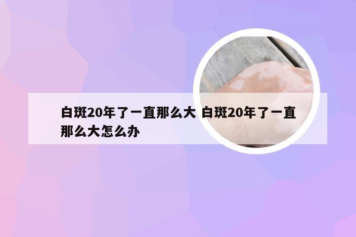 白斑20年了一直那么大 白斑20年了一直那么大怎么办