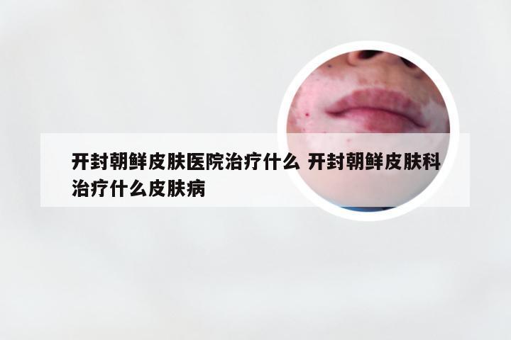 开封朝鲜皮肤医院治疗什么 开封朝鲜皮肤科治疗什么皮肤病