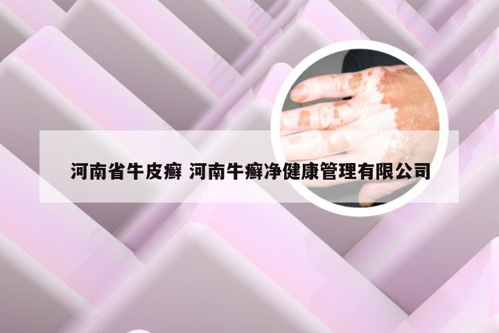 河南省牛皮癣 河南牛癣净健康管理有限公司