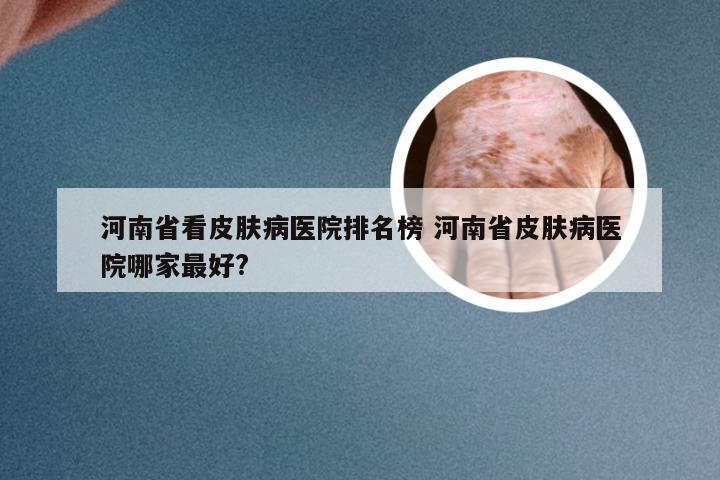 河南省看皮肤病医院排名榜 河南省皮肤病医院哪家最好?