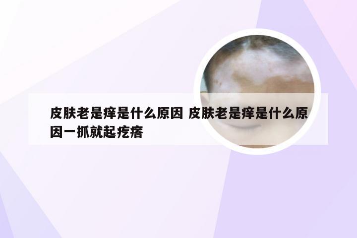 皮肤老是痒是什么原因 皮肤老是痒是什么原因一抓就起疙瘩