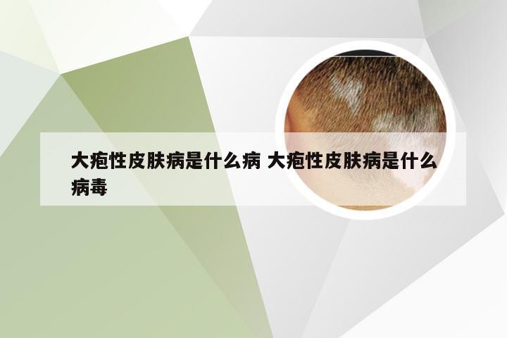 大疱性皮肤病是什么病 大疱性皮肤病是什么病毒