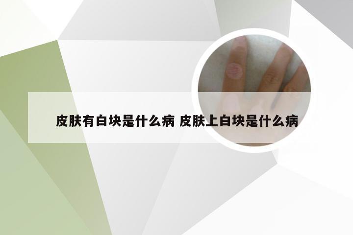 皮肤有白块是什么病 皮肤上白块是什么病