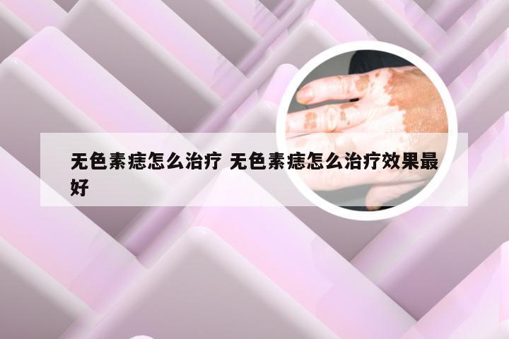 无色素痣怎么治疗 无色素痣怎么治疗效果最好