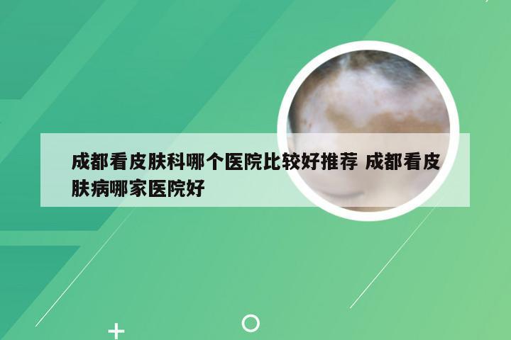 成都看皮肤科哪个医院比较好推荐 成都看皮肤病哪家医院好