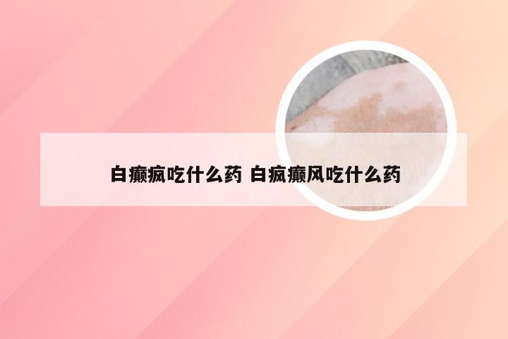 白癫疯吃什么药 白疯癫风吃什么药