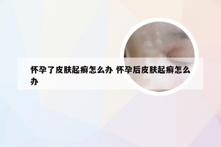 怀孕了皮肤起癣怎么办 怀孕后皮肤起癣怎么办