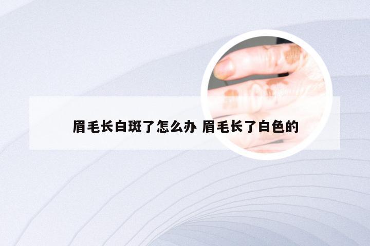 眉毛长白斑了怎么办 眉毛长了白色的